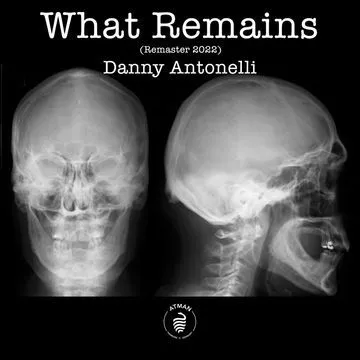 What Remains